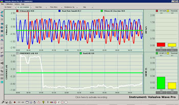 Valsalva Wave Heart Rate Synchrony