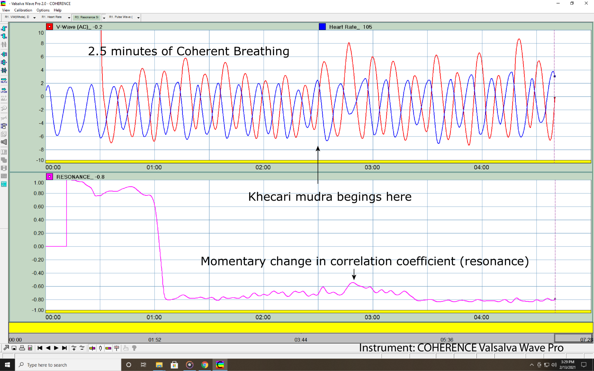 Coherent Breathing Followed By Khechari Mudra